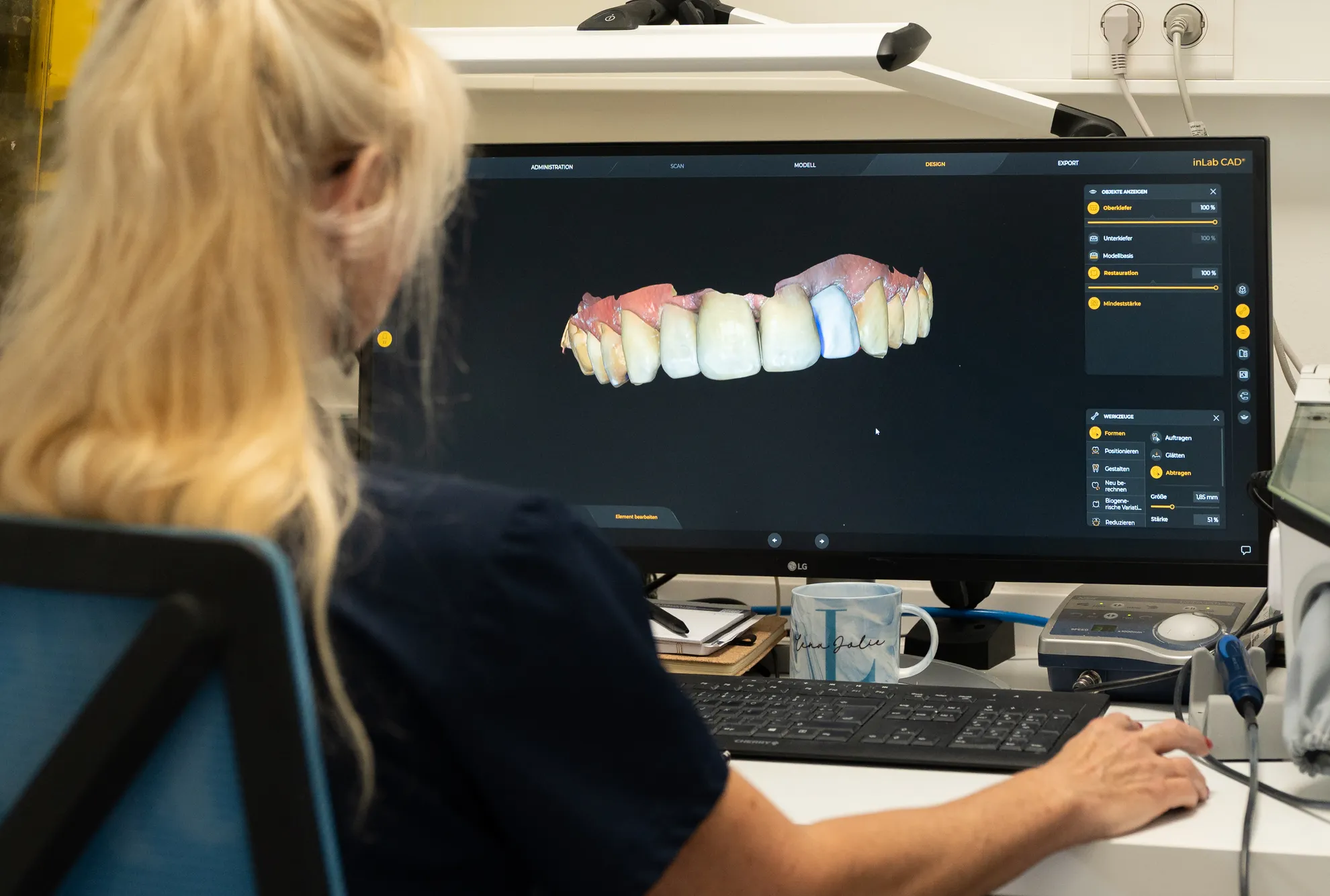 Blick auf den Bildschirm mit einem 3D-Modell des Kiefers